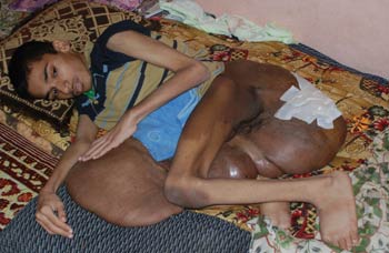 ظهور حالات مرضية غريبة في احدى مناطق الديوانية لااسباب مجهوله (مصور)