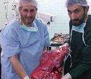 فريق طبي بالنجف يزيل ورم كبير من بطن مريضة +صوره