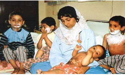 إرسال 19 مصاباً من ضحايا حلبجة الى ايران للعلاج من القصف الكيمياوي