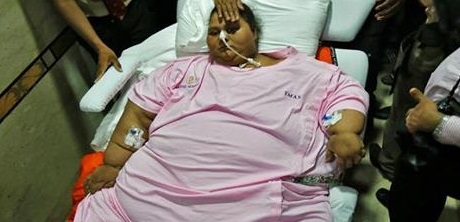 مصر.. وفاة أسمن امرأة في العالم