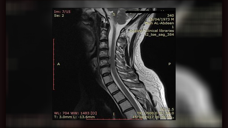 كربلاء:عملية جراحية نوعية في مستشفى الإمام زين العابدين