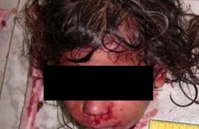 ضرب فتاة في الرابعة من عمرها حتى الموت لأنها تبكي