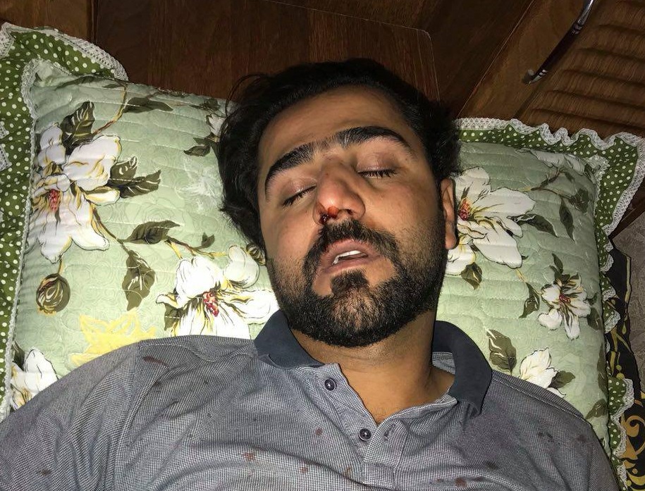 اعتداء على مراسل تلفزيوني في بابل ومركز دعم حرية التعبير يحمل المحافظ مسؤولية سلامته