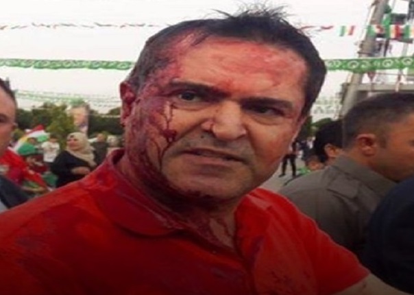 بالصورة:اصابة رئيس قائمة الجيل الجديد في اربيل اثر اعتداء اثناء اقامة مؤتمر انتخابي