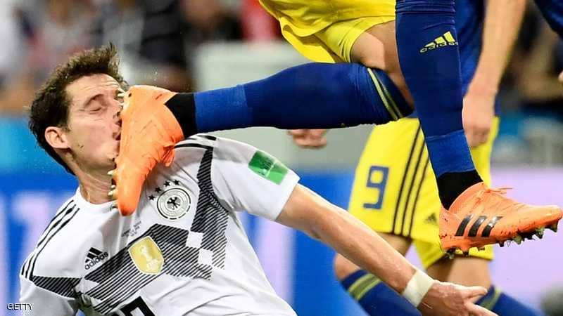 درس من المونديال: لا تستفز البلوغيلت!