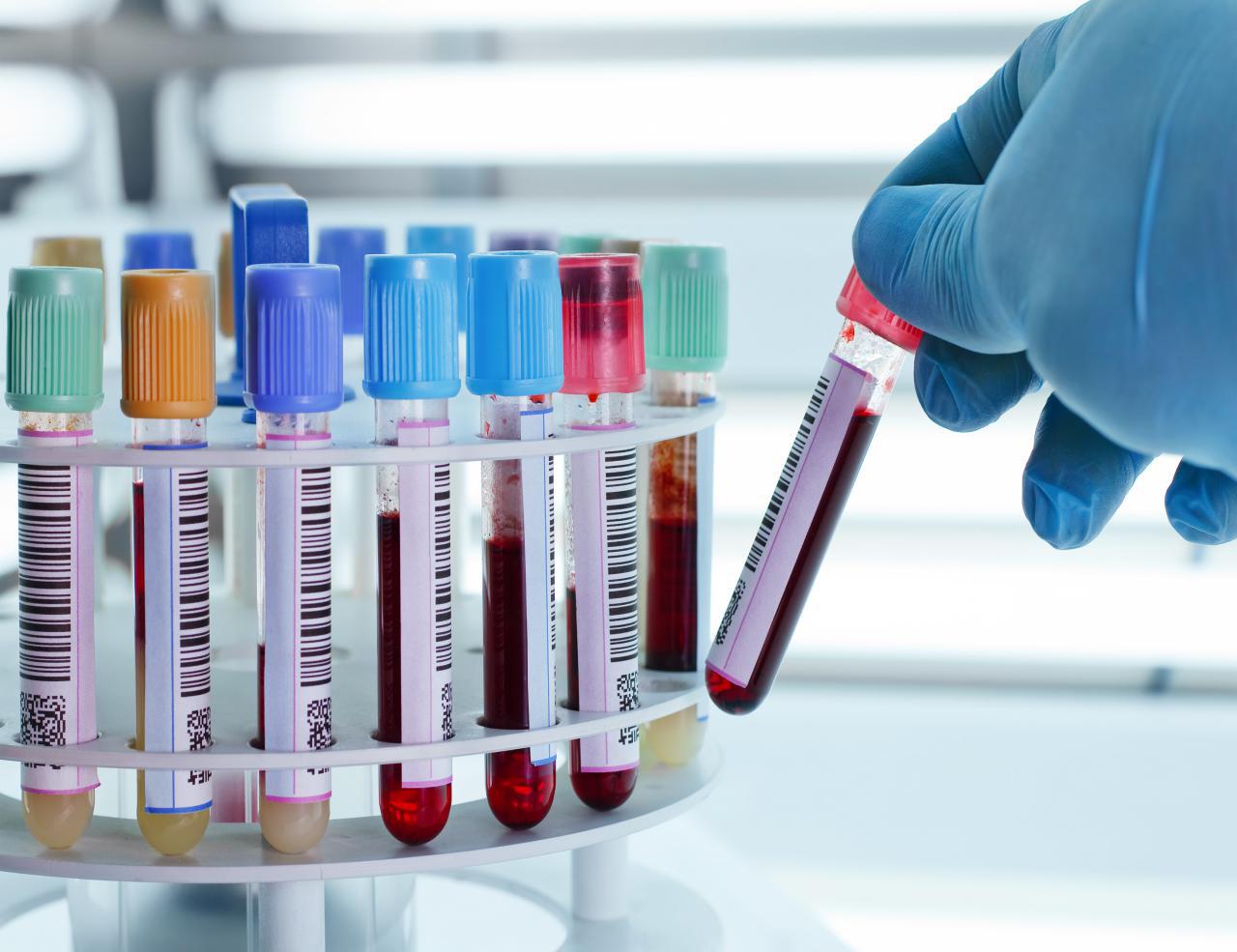 الزراعة تنفي تسجيل اي اصابة بفايروس "نيباه"