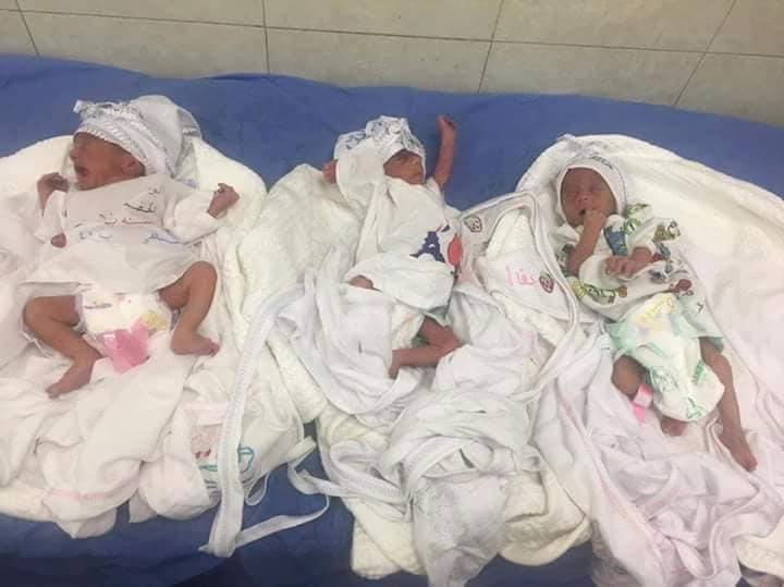 ولادة ثلاث توائم لثلاثينية في مستشفى النسائية والتوليد التعليمي في محافظة كربلاء