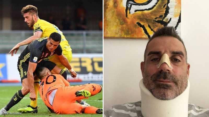 حارس كييفو يشكر "الأسطورة" رونالدو.. بعد أن كسر أنفه