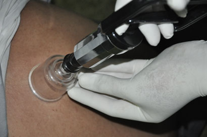 كربلاء :الحجامة النسائية تحيا من جديد