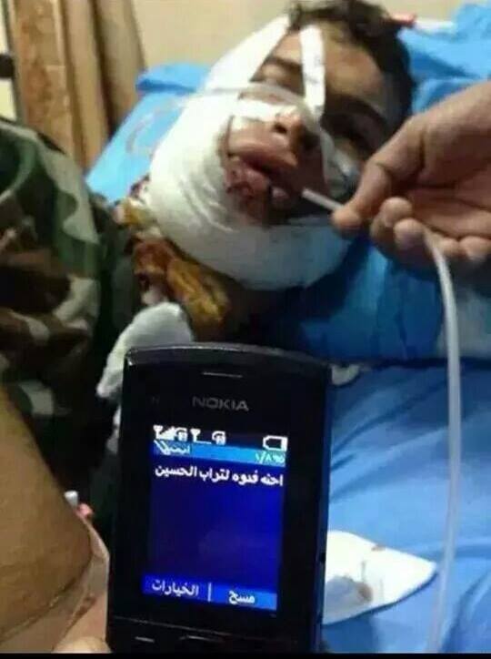 جريح عراقي يقاتل الدواعش لم يستطيع التكلم ..شاهد ماذا كتب بهاتفه؟!!