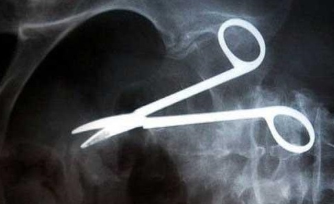 مقص ″يرقد″ اثنا عشرا عاما في جسم مريض