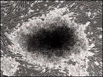 سبق علمي قد يقضى على رفض الجسم للأعضاء المزروعة