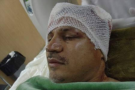 لاعب الكرة  الإيراني علي دائي يتعرض لحادث سيارة