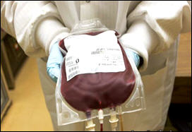 كيفية امتصاص الفركتوز المسبب لدهون الدم تختلف بين النساء والرجال