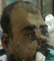 صورة رأس الارهابي الذي فجر الزوار بالبطحاء إنتشرت على النت ساعدت بالتعرف عليه عن طريق أحد المواطنين