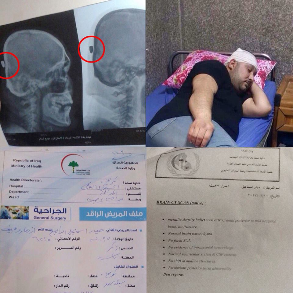 كربلاء:فوز ريال مدريد يتسبب بوفاة طفلة واصابة اخر برصاصة في رأسه بسبب اطلاق العيارات النارية (مصور)