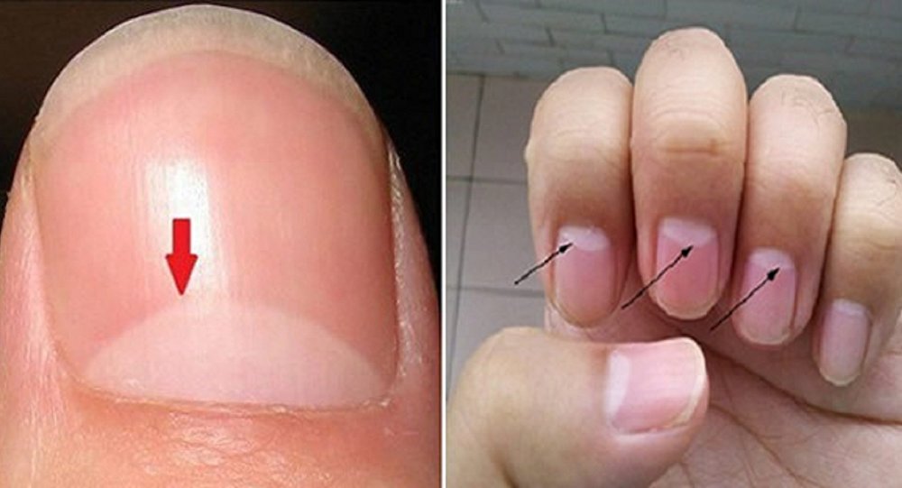 ماذا يعني وجود "نصف قمر صغير" على أظافرك ؟