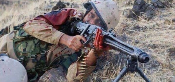 شاهد كيف يقاتل  جندي عراقي  الارهابيين رغم جروحه في معركة الانبار