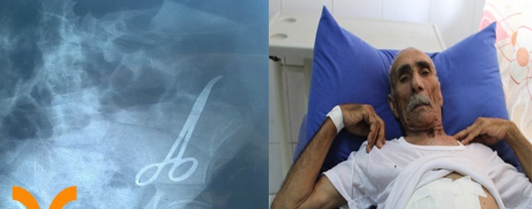 الصدفة تكشف عن (مقص) عمليات منسي في بطن مواطن بصري لأربعة سنوات