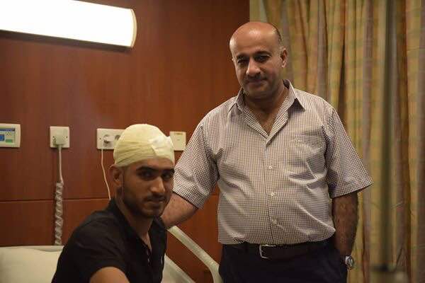 مستشفى الكفيل بكربلاء تنقذ جريح من الحشد الشعبي فقد النصف الخلفي من جمجمته