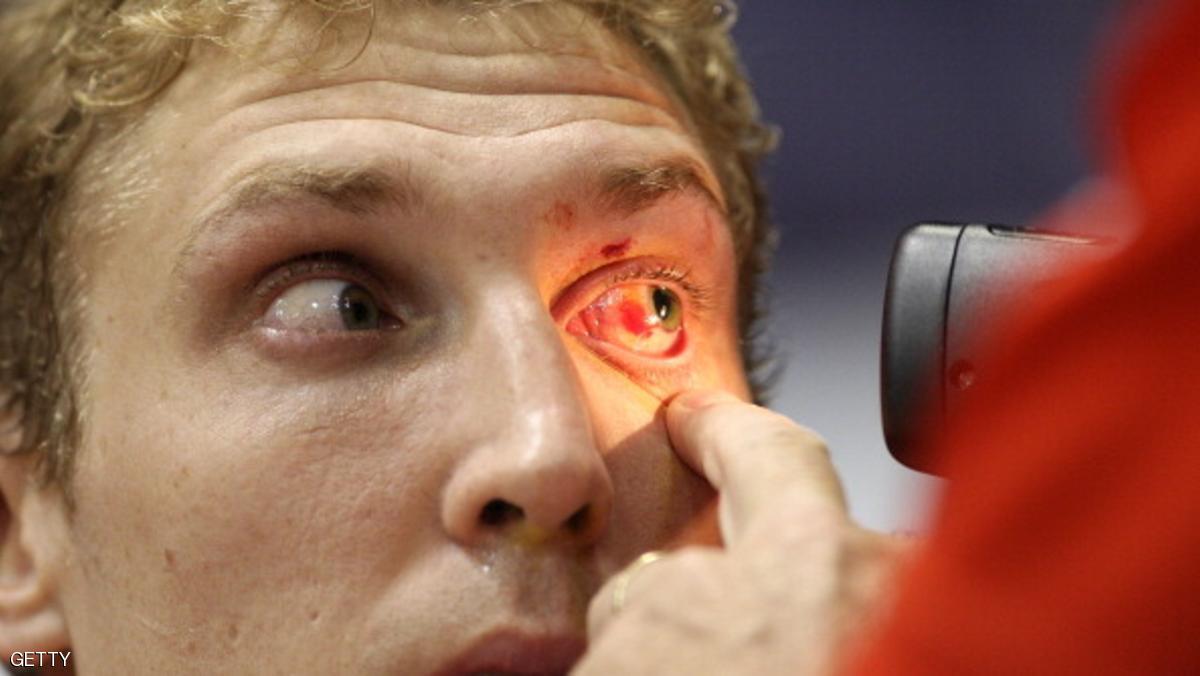 الأجهزة الإلكترونية .. "خطر" على العين والجسم