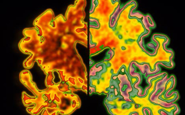 دراسة أميركية تحث على الصيام يومين في الأسبوع