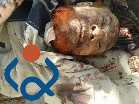 ماذا قالت  وزارة الصحة حول جثة المجرم عزة الدوري