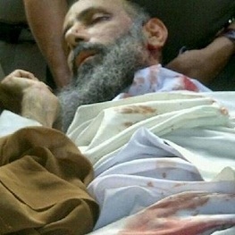 شقيقة اية الله النمر تروي ما جرى في آخر زيارة لأخيها الأسير المعتقل في مشفى بالرياض