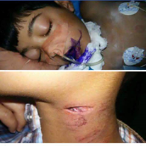 صحة كربلاء المقدسة توضح  ملابسات موضوع ( عضة الكلب ) التي أودت بحياة شخصين في  المحافظة