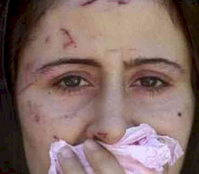 «محرقة النساء في كردستان العراق» تلتهم فتاة كل 20 ساعة