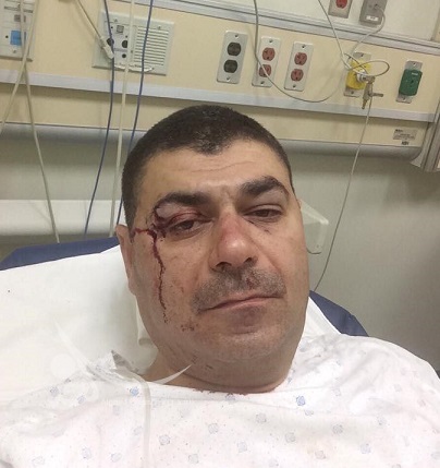 بالصور :اصابة حيدر الملا  اثر حادث في بيروت