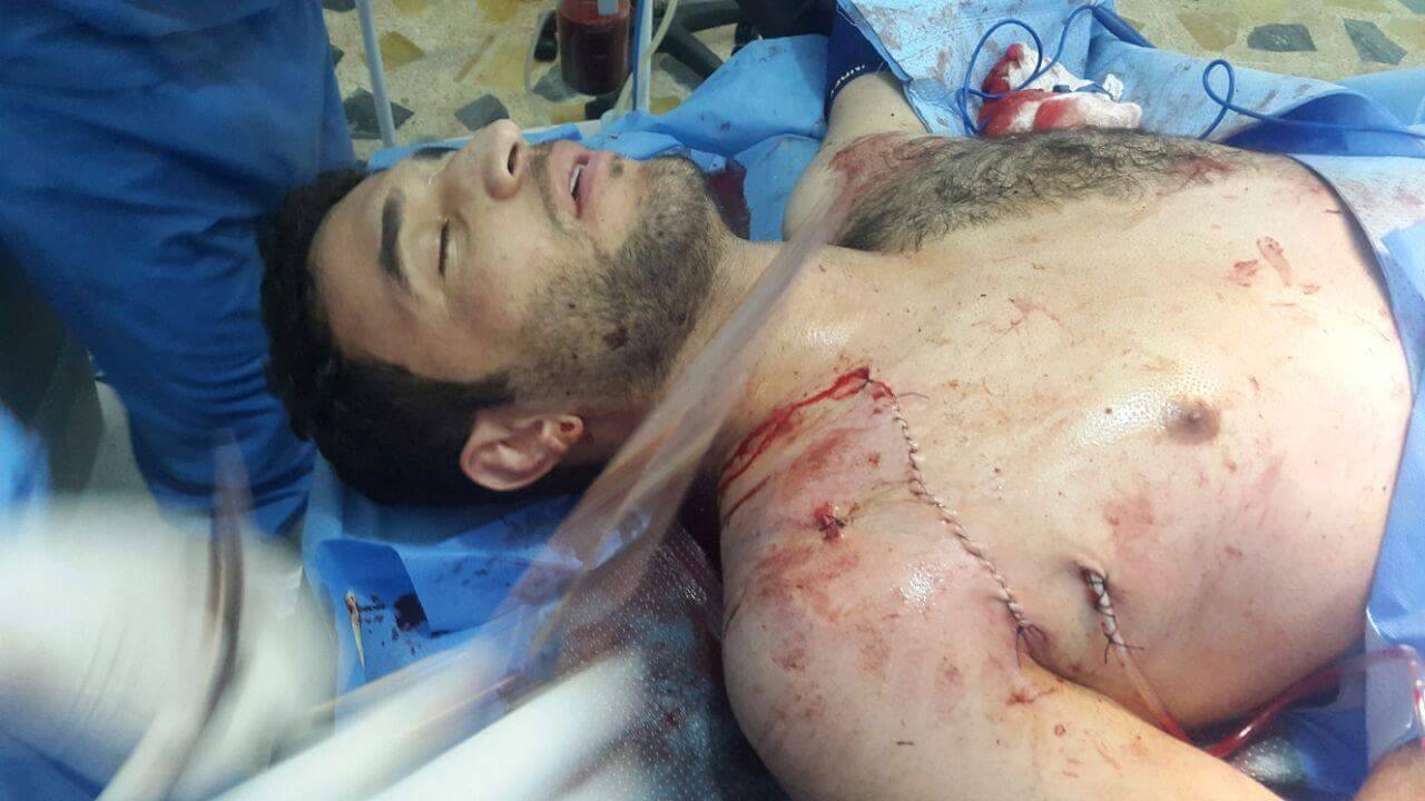 بالصور:جراحون كربلائيون ينقذون حياة مقاتل " ميساني " في الحشد الشعبي