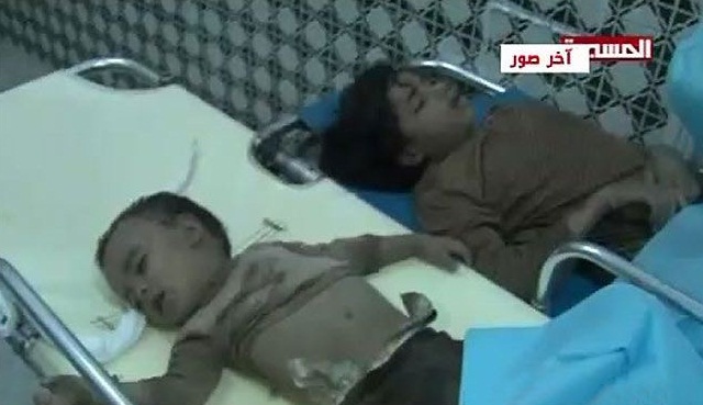 صور  مفجعة للعدوان السعودي على اليمن