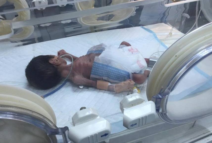 إنقاذ حياة طفل عمرهُ الجنيني ستة أشهر في كربلاء(مصور)