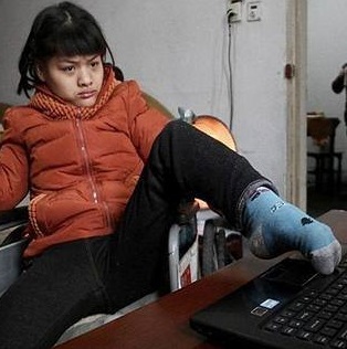 فتاة صينية مشلولة تطبع رواية من 60 ألف كلمة باستخدام قدمها!!!