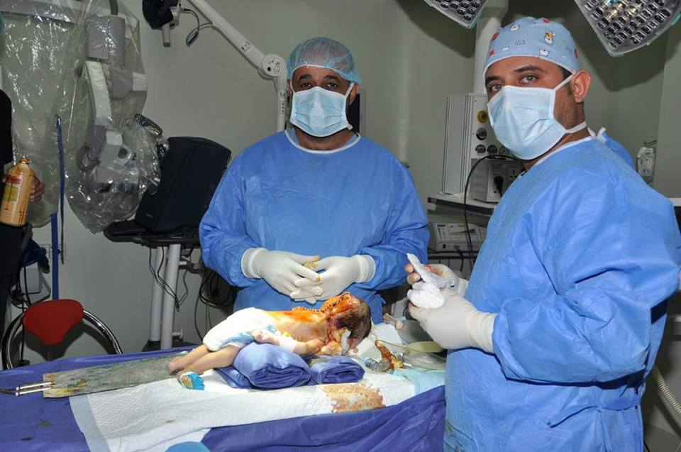 بالصور:عملية جراحية نادرة لطفلة رضيعة بعمر ( 57 ) يوماََ في كربلاء
