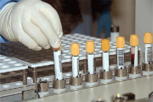 صحة كربلاء تشهد احتفالا سنويا بمناسبة اليوم العلمي للمختبر