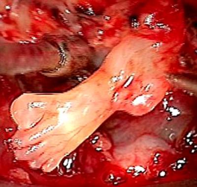 بالصور: العثور على قدم داخل دماغ طفل !!