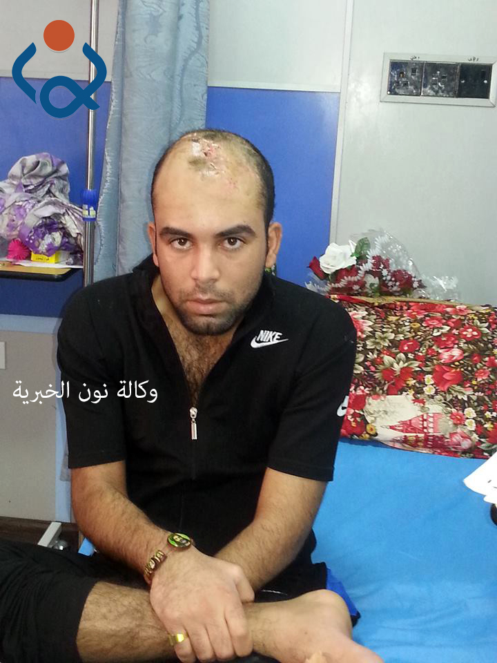 (بالتفاصيل والصور):انقاذ مقاتل من ابناء الانبار في مستشفى بكربلاء