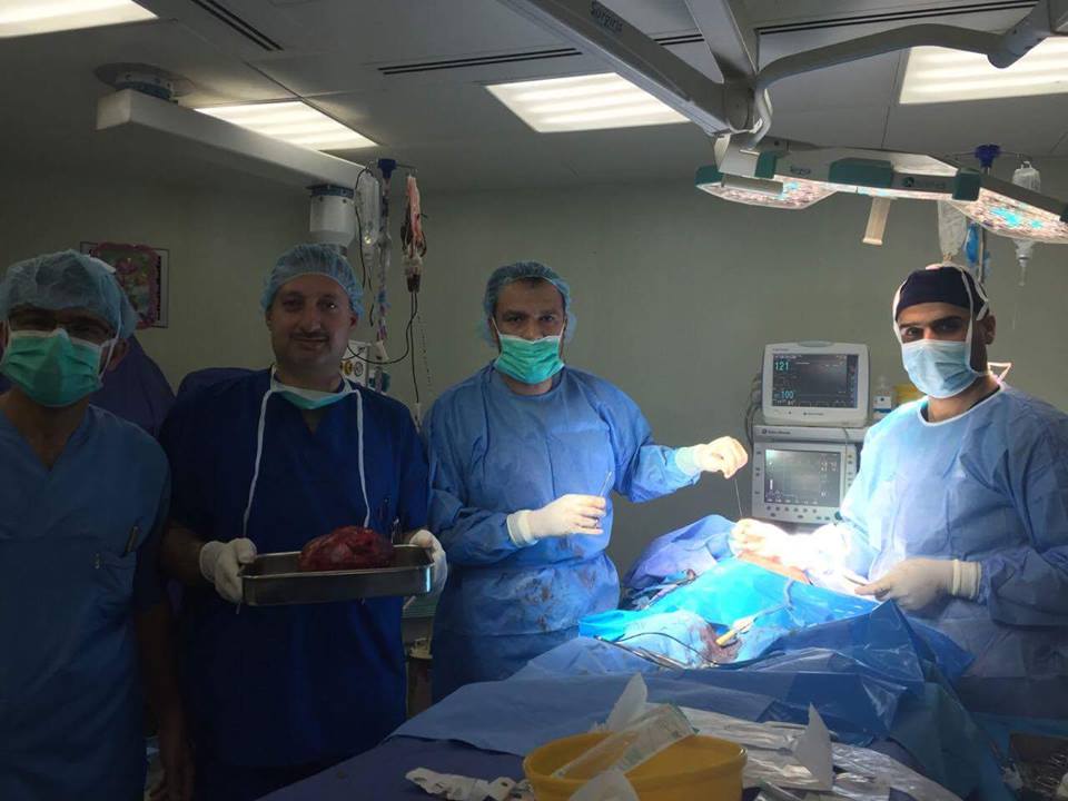 فريق طبي بكربلاء ينجح بإستئصال ورم وزنه ( 5 ) كغم من بطن طفل ميساني عمره إثنان وأربعون شهراََ