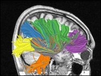 أي بي إم تنوي اختراع حواسيب تحاكي الدماغ