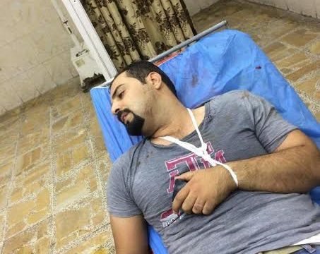 حماية رئيس الجمهورية يعتدون بالضرب على صحفي