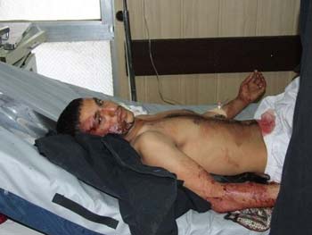 وفد الامانتين العامتين للعتبتين الحسينية والعباسية المقدستين يتفقد جرحى الانفجار الدامي في كركوك