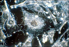 فحص ثلاثي الابعاد للخلايا قد يفتح الباب لعلاج السرطان