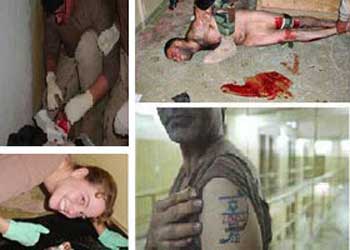 شامير: تل أبيب سرقت الأعضاء البشرية لسجناء أبو غريب في العراق