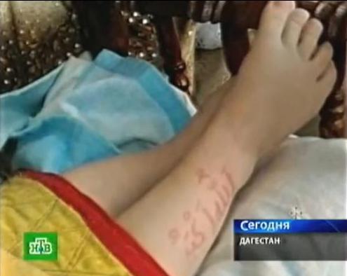 آيات قرآنية تظهر على جسد رضيع في روسيا