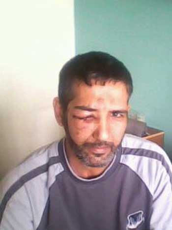 بعد تسع عمليات في اكثر من دولة..اطباء العراق وايران والأردن ينجحون في انقاذ حياة شاب سقط من الطابق الثالث