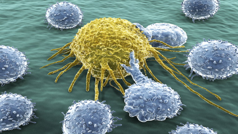 أحاسيس في جسمك قد تدل على ورم سرطاني متنامٍ !