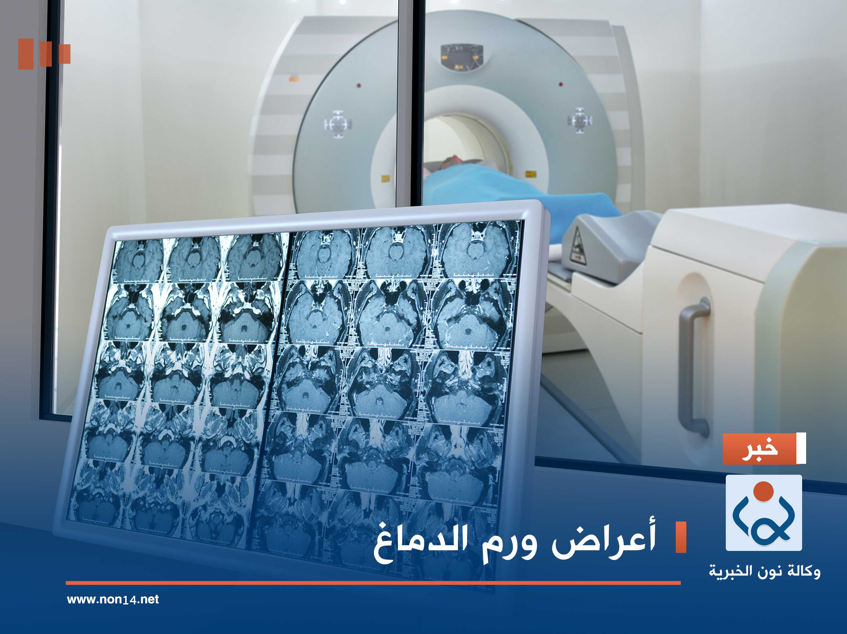 أعراض ورم الدماغ