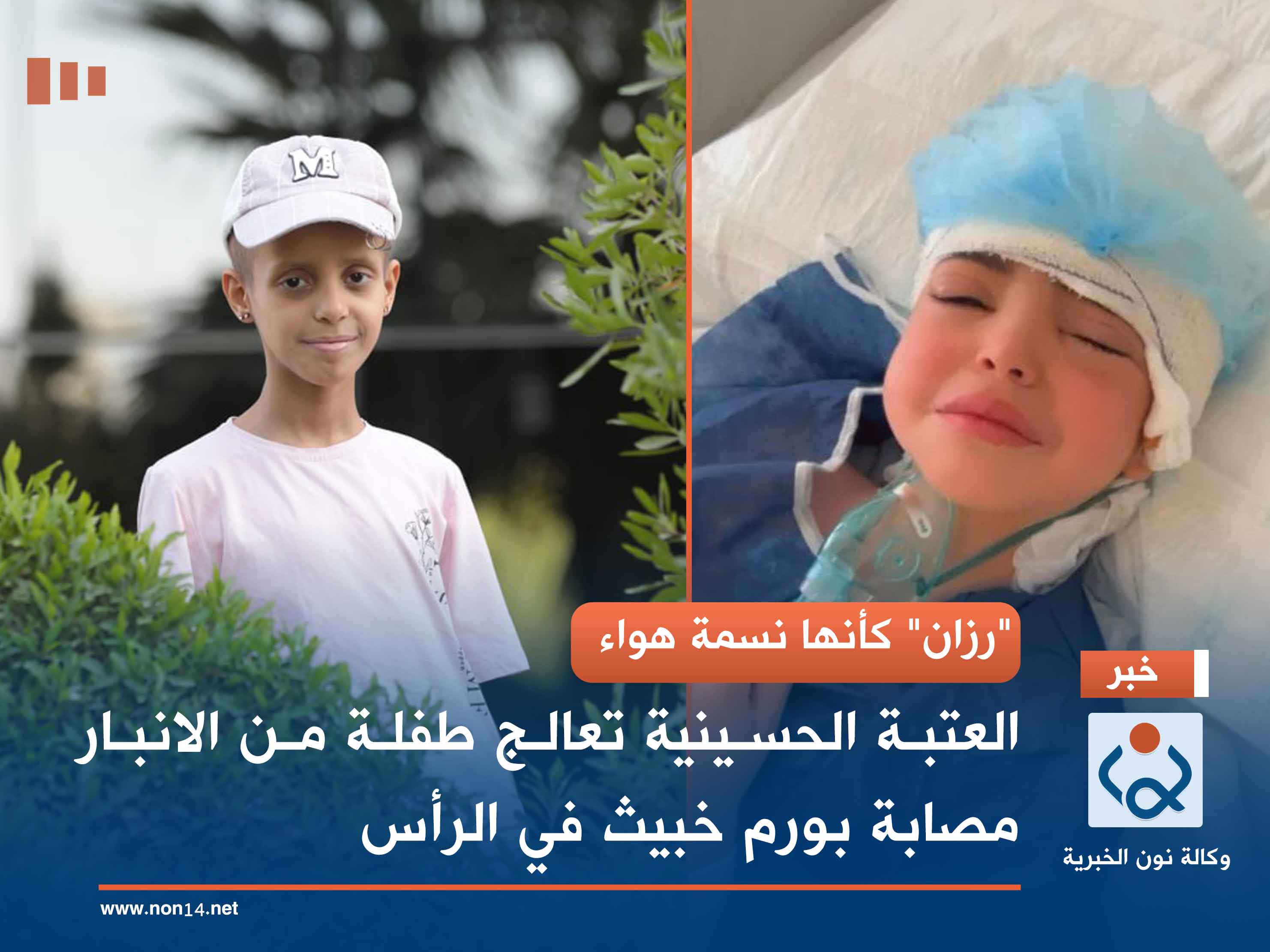 "رزان" كأنها نسمة هواء.. العتبة الحسينية تعالج طفلة من الانبار مصابة بورم خبيث في الرأس (صور)